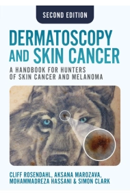 Coberta de Dermatoscopy and Skin Cancer, second edition: A handbook for hunters of skin cancer and melanoma